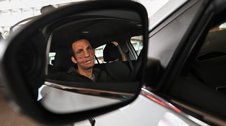 Önce yüzü, sonra hayatı değişti