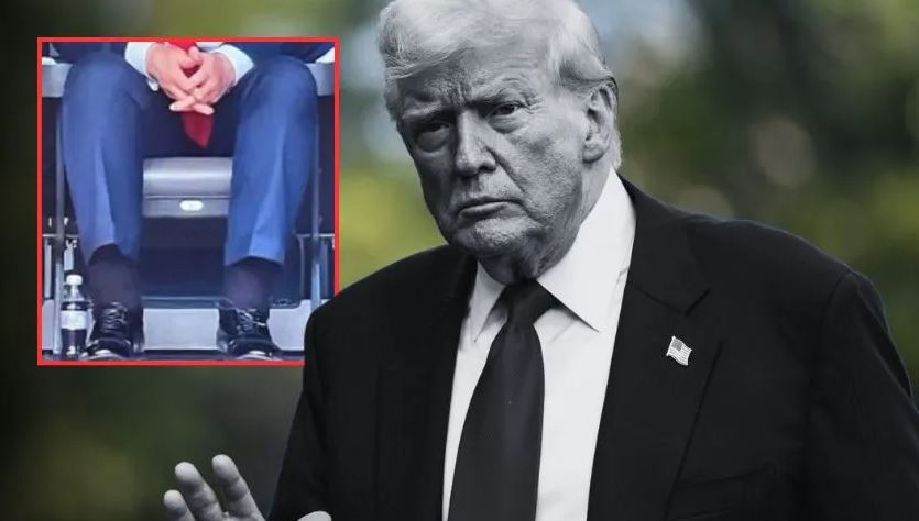 Bacağındaki şişlik dikkat çekti: ABD Başkanı Donald Trump’ın hastalığı belli oldu!