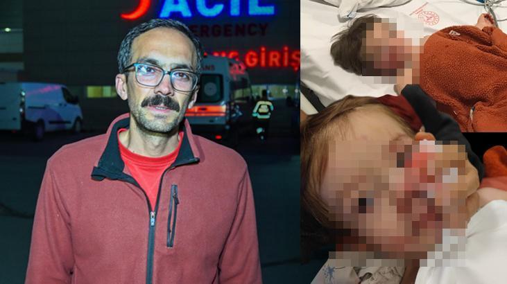 Başkentte pitbull dehşeti!