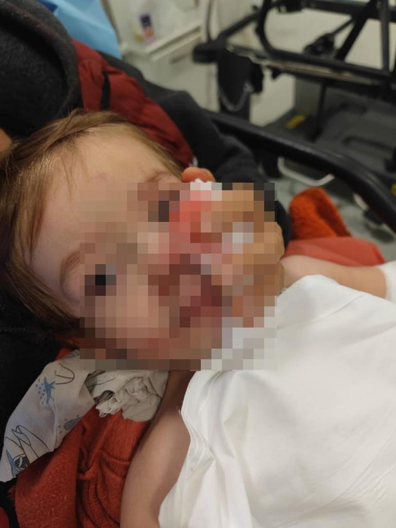 Başkentte pitbull dehşeti! Acılı babadan yardım çağrısı: Çocuklarımın yüzüne bakamam