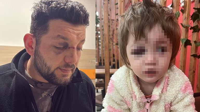 Yalova’da komşu dehşeti! Baba ve kucağındaki bebeğine saldırdılar